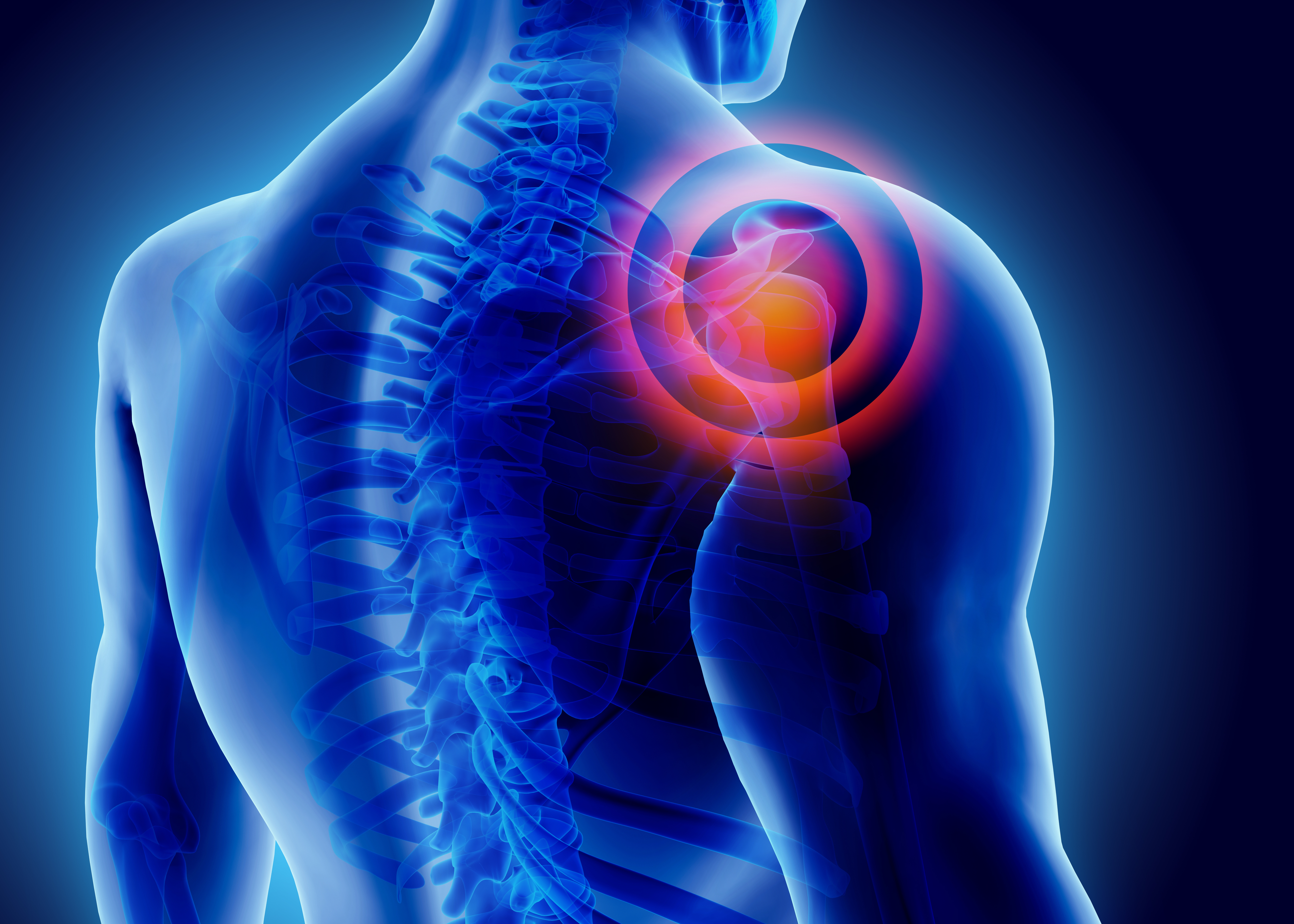 Does common NHS shoulder surgery work? | University of Oxford